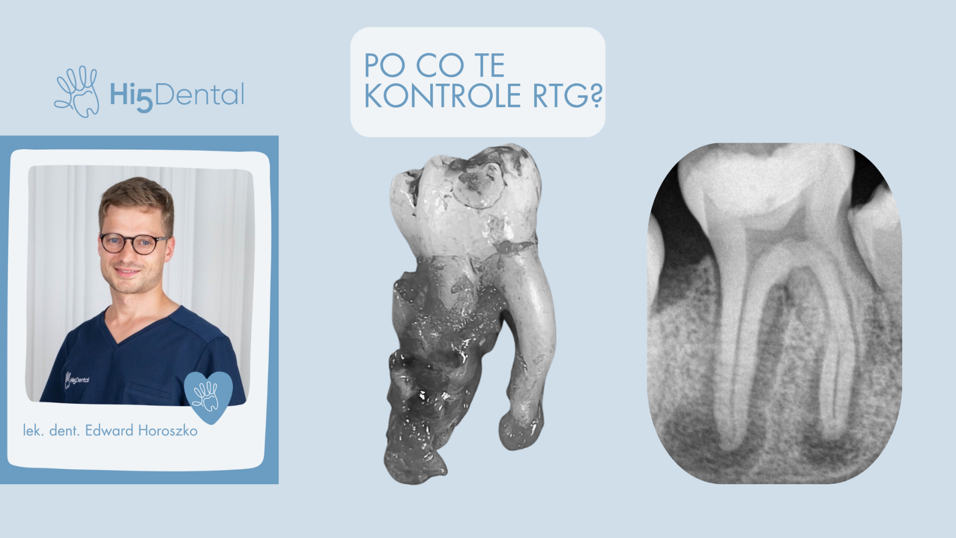 blog-image